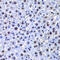 Protein Kinase, DNA-Activated, Catalytic Subunit antibody, 23-125, ProSci, Immunohistochemistry frozen image 