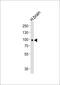 BDNF/NT-3 growth factors receptor antibody, M01388, Boster Biological Technology, Western Blot image 