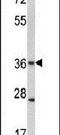 Gap Junction Protein Beta 3 antibody, PA5-11635, Invitrogen Antibodies, Western Blot image 