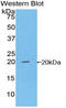 NME/NM23 Nucleoside Diphosphate Kinase 1 antibody, LS-C295665, Lifespan Biosciences, Western Blot image 
