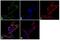 Acid Phosphatase, Prostate antibody, MA5-13078, Invitrogen Antibodies, Immunofluorescence image 