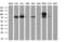 Acyl-CoA Synthetase Short Chain Family Member 2 antibody, M02809-1, Boster Biological Technology, Western Blot image 