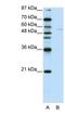 Grainyhead Like Transcription Factor 3 antibody, NBP1-80355, Novus Biologicals, Western Blot image 