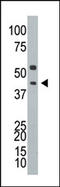 Sca3 antibody, AP12104PU-N, Origene, Western Blot image 