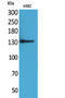 Intercellular Adhesion Molecule 5 antibody, STJ96614, St John