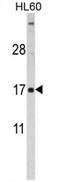 Follicle Stimulating Hormone Subunit Beta antibody, AP17400PU-N, Origene, Western Blot image 