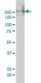 Myosin Heavy Chain 9 antibody, H00004627-M01, Novus Biologicals, Western Blot image 