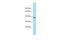 MAP3K12 Binding Inhibitory Protein 1 antibody, A05243, Boster Biological Technology, Western Blot image 