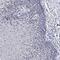 Polycomb Group Ring Finger 5 antibody, NBP1-82745, Novus Biologicals, Immunohistochemistry paraffin image 