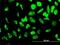 Ribosomal Protein S23 antibody, H00006228-M02, Novus Biologicals, Immunocytochemistry image 