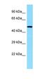 Cytokine-dependent hematopoietic cell linker antibody, orb326530, Biorbyt, Western Blot image 