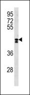 Leucine Rich Repeat Containing 2 antibody, LS-C203858, Lifespan Biosciences, Western Blot image 