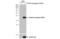 Ubiquitin Conjugating Enzyme E2 B antibody, NBP2-20781, Novus Biologicals, Western Blot image 