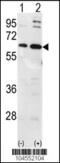 Ubiquilin 1 antibody, 61-130, ProSci, Western Blot image 