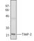 TIMP Metallopeptidase Inhibitor 2 antibody, 635401, BioLegend, Western Blot image 