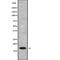 Ubiquitin Conjugating Enzyme E2 B antibody, abx218155, Abbexa, Western Blot image 