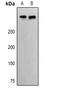 E1A Binding Protein P400 antibody, LS-C668635, Lifespan Biosciences, Western Blot image 