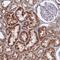 Mitochondrial Ribosomal Protein L22 antibody, NBP2-30482, Novus Biologicals, Immunohistochemistry paraffin image 