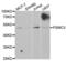 Proteasome 26S Subunit, ATPase 3 antibody, LS-C331808, Lifespan Biosciences, Western Blot image 