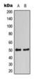 Calcium/Calmodulin Dependent Protein Kinase II Alpha antibody, orb224183, Biorbyt, Western Blot image 