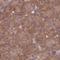 Prefoldin Subunit 6 antibody, NBP2-30389, Novus Biologicals, Immunohistochemistry paraffin image 