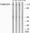 Tubulin Gamma Complex Associated Protein 5 antibody, PA5-39182, Invitrogen Antibodies, Western Blot image 