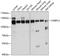 Oxysterol Binding Protein Like 3 antibody, A07039, Boster Biological Technology, Western Blot image 