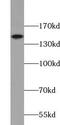 Tight Junction Protein 2 antibody, FNab09752, FineTest, Western Blot image 