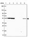 Eukaryotic Translation Initiation Factor 3 Subunit D antibody, PA5-64108, Invitrogen Antibodies, Western Blot image 