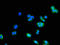 Adenylate Kinase 5 antibody, LS-C502246, Lifespan Biosciences, Immunofluorescence image 