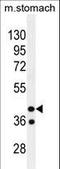 Gypsy Retrotransposon Integrase 1 antibody, LS-C166477, Lifespan Biosciences, Western Blot image 