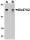 Solute Carrier Family 37 Member 2 antibody, orb94369, Biorbyt, Western Blot image 