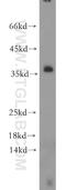 Linker For Activation Of T Cells antibody, 11326-1-AP, Proteintech Group, Western Blot image 