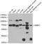 HIRA Interacting Protein 3 antibody, GTX65853, GeneTex, Western Blot image 