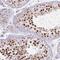 Mitochondrial Ribosomal Protein L34 antibody, NBP2-13616, Novus Biologicals, Immunohistochemistry paraffin image 