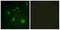 Non-histone chromosomal protein HMG-14 antibody, P03051, Boster Biological Technology, Immunohistochemistry paraffin image 