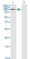 Laminin Subunit Alpha 5 antibody, H00003911-M01, Novus Biologicals, Western Blot image 