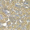 Proteasome 26S Subunit, Non-ATPase 5 antibody, A6954, ABclonal Technology, Immunohistochemistry paraffin image 