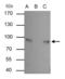 Junction Plakoglobin antibody, GTX114156, GeneTex, Immunoprecipitation image 