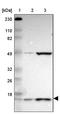 Ubiquitin Conjugating Enzyme E2 D4 (Putative) antibody, PA5-52024, Invitrogen Antibodies, Western Blot image 