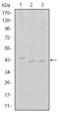 Cyclin Dependent Kinase 9 antibody, STJ97950, St John