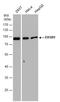 EWS RNA Binding Protein 1 antibody, GTX114069, GeneTex, Western Blot image 