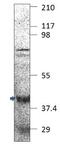 F-Box Protein 32 antibody, GTX47819, GeneTex, Western Blot image 