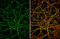 Sodium Voltage-Gated Channel Alpha Subunit 9 antibody, GTX134494, GeneTex, Immunofluorescence image 