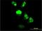 Centromere Protein M antibody, H00079019-M01, Novus Biologicals, Immunocytochemistry image 