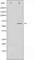 Serum/Glucocorticoid Regulated Kinase 1 antibody, abx012084, Abbexa, Western Blot image 