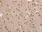 Alpha-1-antitrypsin antibody, MBS2518991, MyBioSource, Immunohistochemistry paraffin image 