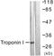 Troponin I3, Cardiac Type antibody, LS-C117825, Lifespan Biosciences, Western Blot image 