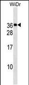 Mediator Complex Subunit 30 antibody, PA5-49159, Invitrogen Antibodies, Western Blot image 