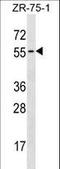 Transcobalamin 1 antibody, LS-C157162, Lifespan Biosciences, Western Blot image 